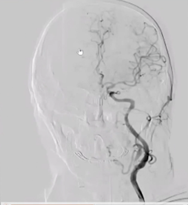 病历夹什么径技·第152期｜串联营病历夹：川陕大营_https://www.jmylbn.com_新闻资讯_第88张