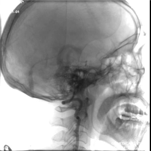 病历夹什么径技·第152期｜串联营病历夹：川陕大营_https://www.jmylbn.com_新闻资讯_第24张