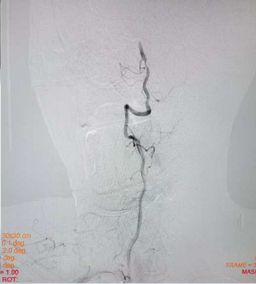 病历夹什么径技·第152期｜串联营病历夹：川陕大营_https://www.jmylbn.com_新闻资讯_第12张