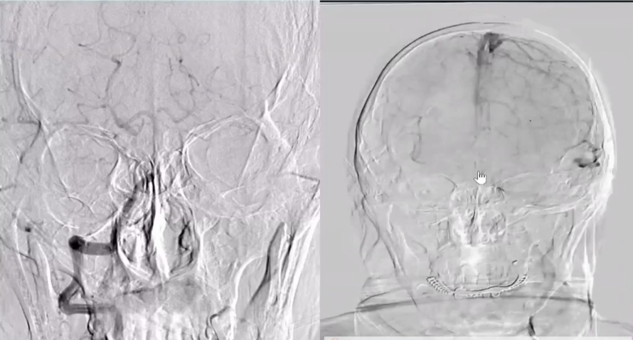 病历夹什么径技·第152期｜串联营病历夹：川陕大营_https://www.jmylbn.com_新闻资讯_第82张