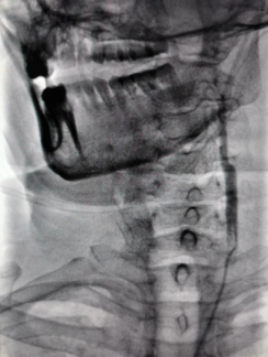 病历夹什么径技·第152期｜串联营病历夹：川陕大营_https://www.jmylbn.com_新闻资讯_第18张