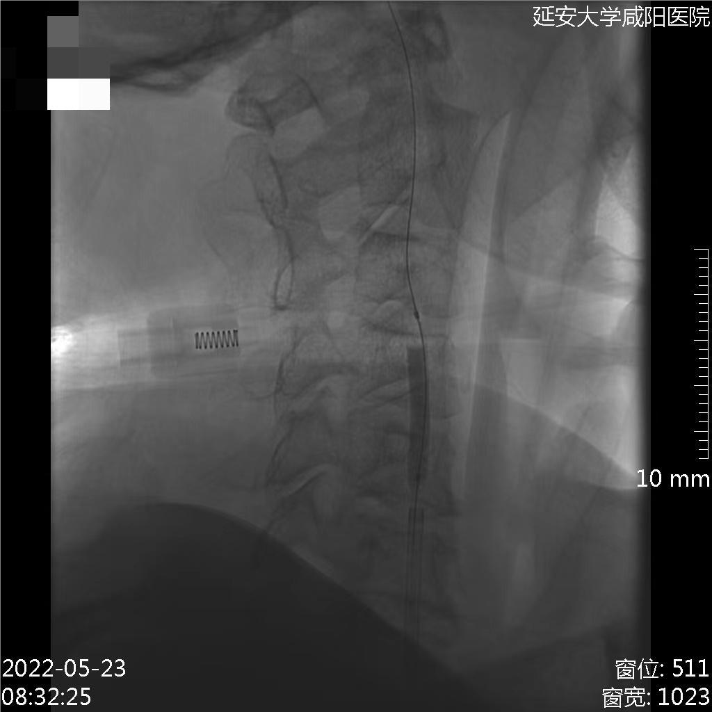 病历夹什么径技·第152期｜串联营病历夹：川陕大营_https://www.jmylbn.com_新闻资讯_第63张