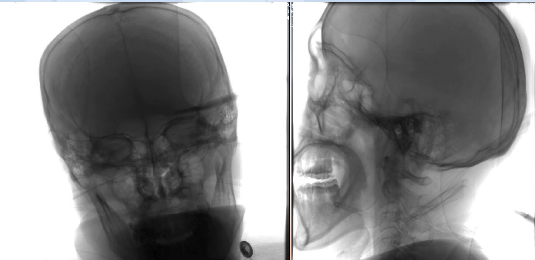 病历夹什么径技·第152期｜串联营病历夹：川陕大营_https://www.jmylbn.com_新闻资讯_第21张