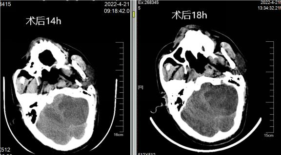 病历夹什么径技·第152期｜串联营病历夹：川陕大营_https://www.jmylbn.com_新闻资讯_第30张