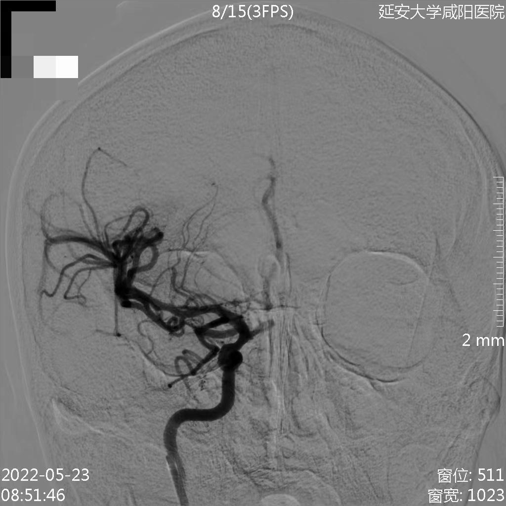 病历夹什么径技·第152期｜串联营病历夹：川陕大营_https://www.jmylbn.com_新闻资讯_第65张