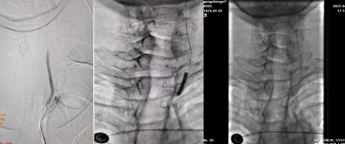 病历夹什么径技·第152期｜串联营病历夹：川陕大营_https://www.jmylbn.com_新闻资讯_第23张