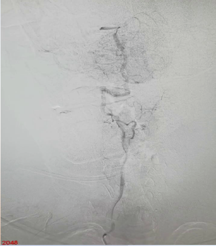 病历夹什么径技·第152期｜串联营病历夹：川陕大营_https://www.jmylbn.com_新闻资讯_第13张