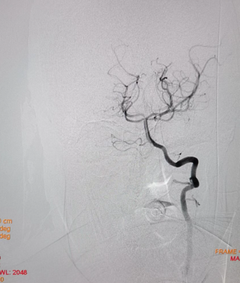 病历夹什么径技·第152期｜串联营病历夹：川陕大营_https://www.jmylbn.com_新闻资讯_第25张