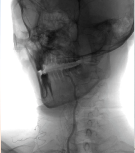 病历夹什么径技·第152期｜串联营病历夹：川陕大营_https://www.jmylbn.com_新闻资讯_第11张