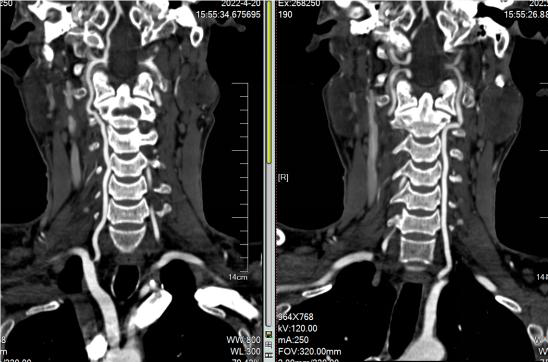 病历夹什么径技·第152期｜串联营病历夹：川陕大营_https://www.jmylbn.com_新闻资讯_第10张