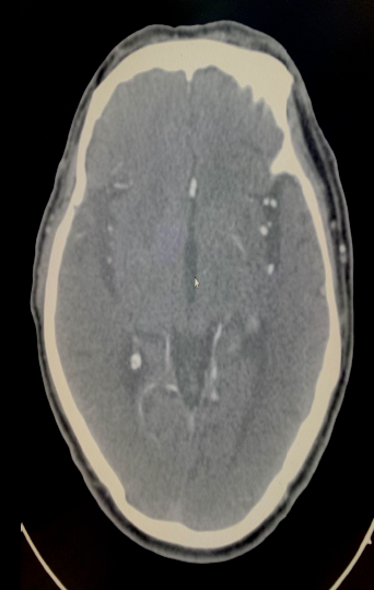 病历夹什么径技·第152期｜串联营病历夹：川陕大营_https://www.jmylbn.com_新闻资讯_第79张