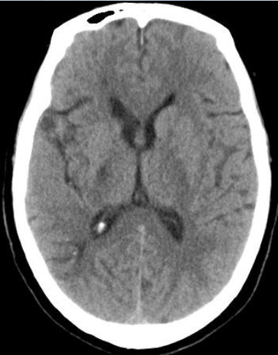 病历夹什么径技·第152期｜串联营病历夹：川陕大营_https://www.jmylbn.com_新闻资讯_第46张