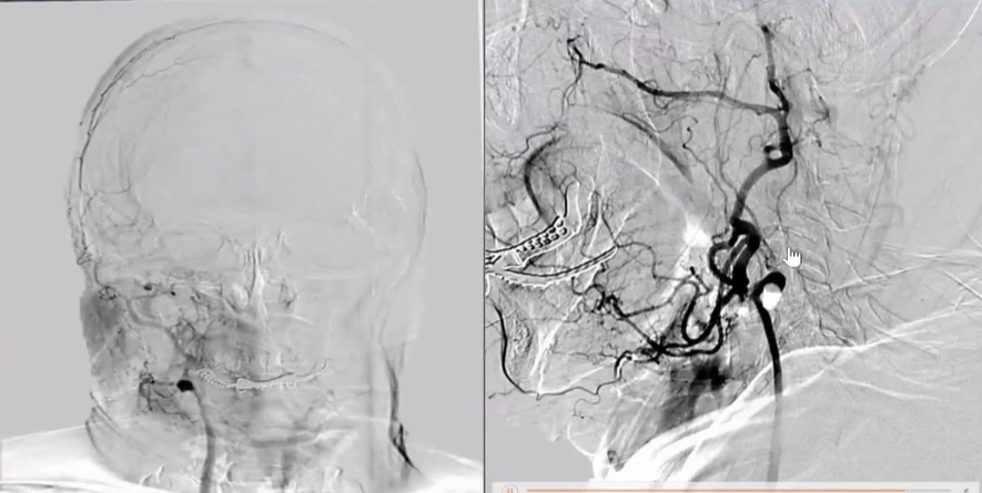病历夹什么径技·第152期｜串联营病历夹：川陕大营_https://www.jmylbn.com_新闻资讯_第81张