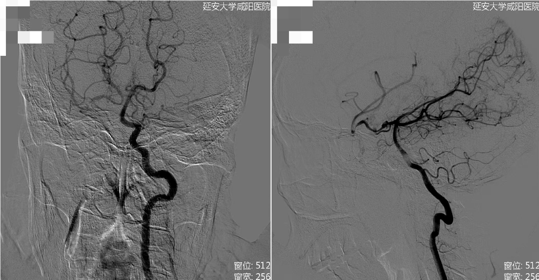病历夹什么径技·第152期｜串联营病历夹：川陕大营_https://www.jmylbn.com_新闻资讯_第60张
