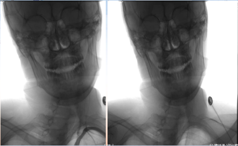 病历夹什么径技·第152期｜串联营病历夹：川陕大营_https://www.jmylbn.com_新闻资讯_第17张