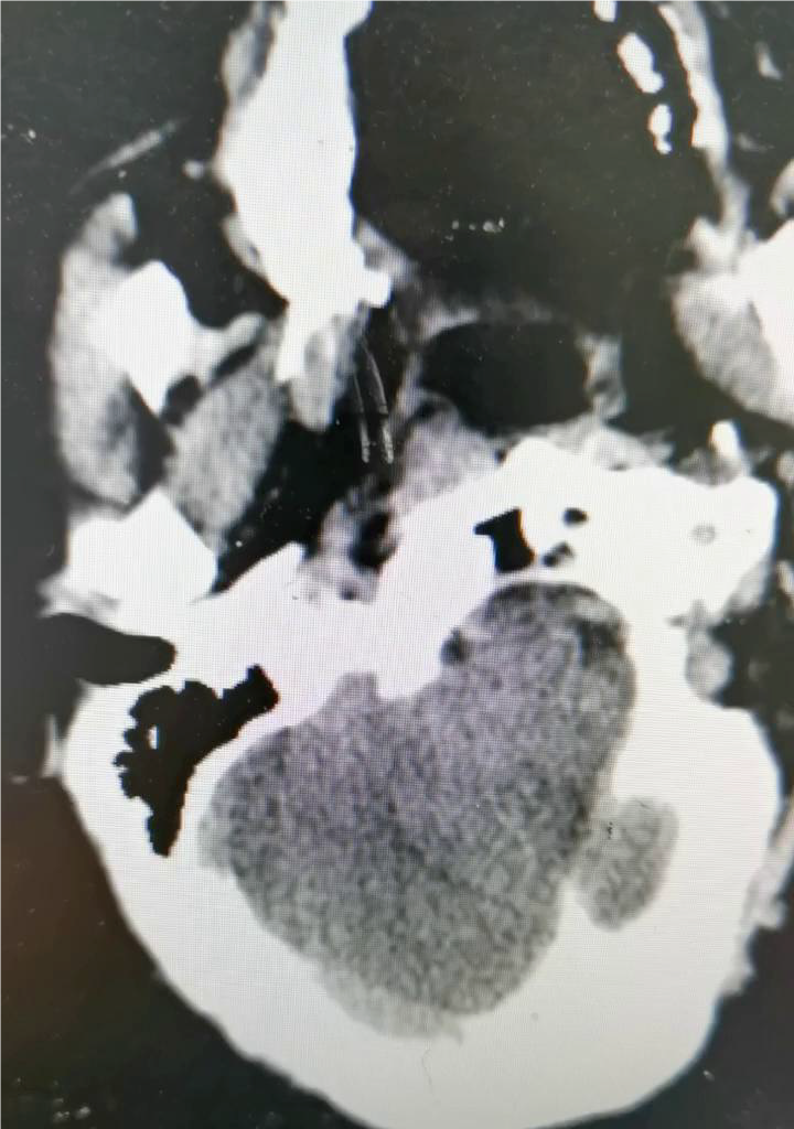病历夹什么径技·第152期｜串联营病历夹：川陕大营_https://www.jmylbn.com_新闻资讯_第8张