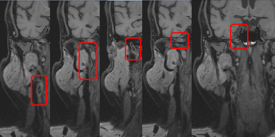 病历夹什么径技·第152期｜串联营病历夹：川陕大营_https://www.jmylbn.com_新闻资讯_第42张