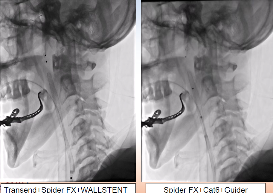 病历夹什么径技·第152期｜串联营病历夹：川陕大营_https://www.jmylbn.com_新闻资讯_第86张