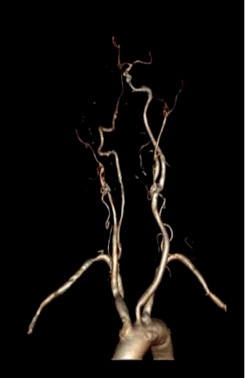 病历夹什么径技·第152期｜串联营病历夹：川陕大营_https://www.jmylbn.com_新闻资讯_第77张