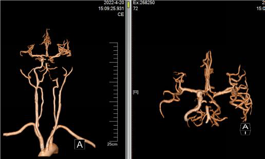 病历夹什么径技·第152期｜串联营病历夹：川陕大营_https://www.jmylbn.com_新闻资讯_第9张