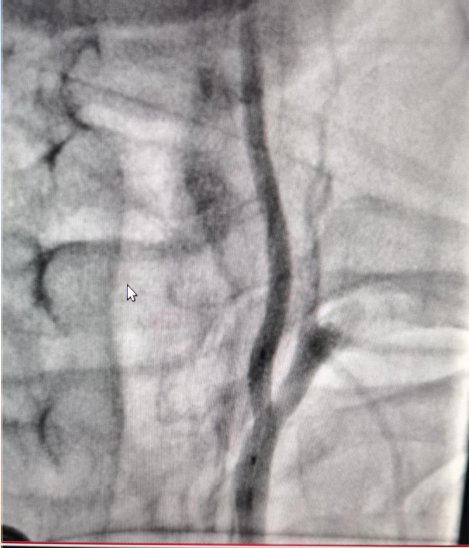 病历夹什么径技·第152期｜串联营病历夹：川陕大营_https://www.jmylbn.com_新闻资讯_第26张