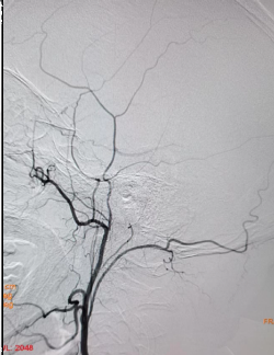 病历夹什么径技·第152期｜串联营病历夹：川陕大营_https://www.jmylbn.com_新闻资讯_第20张