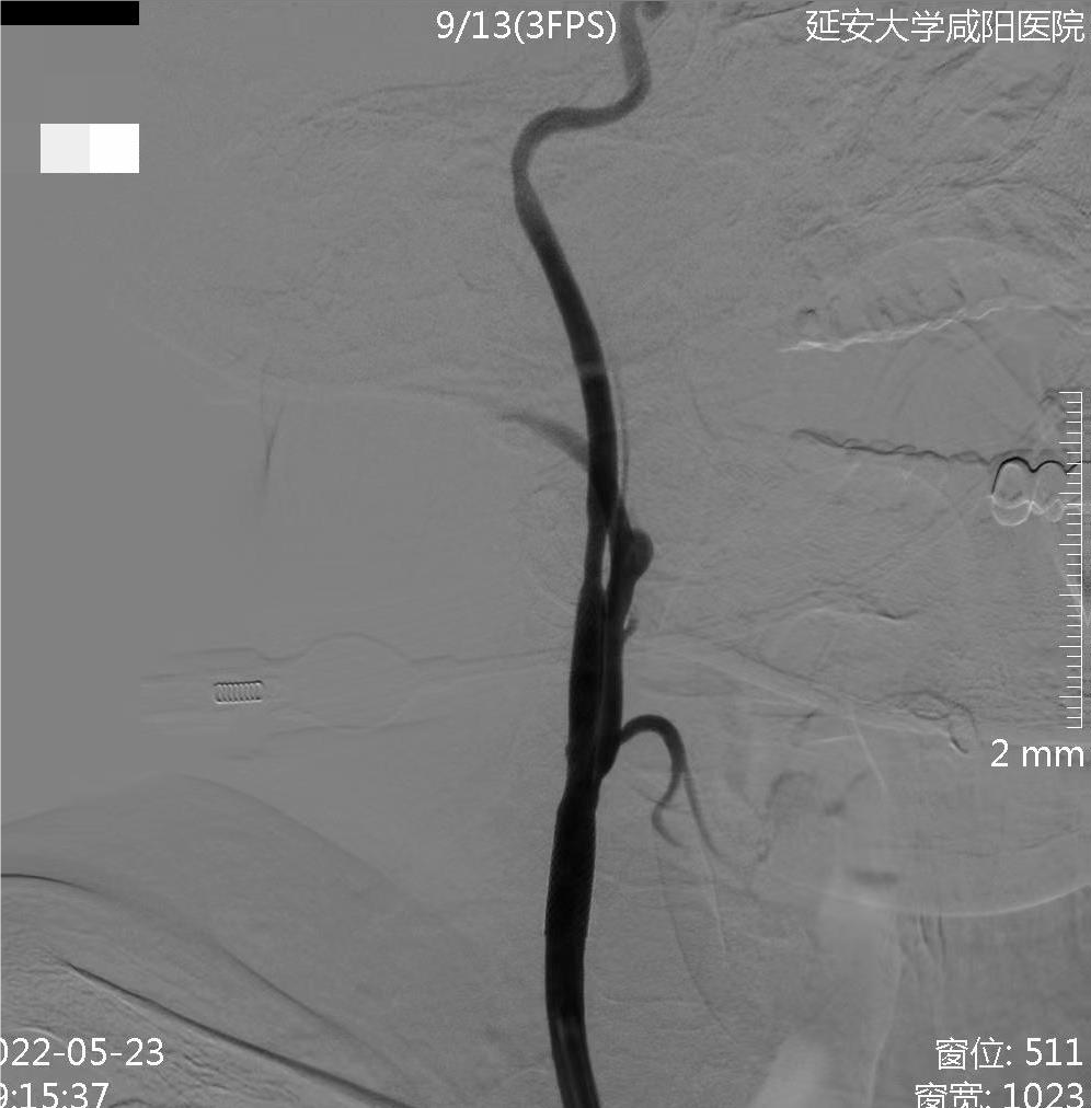 病历夹什么径技·第152期｜串联营病历夹：川陕大营_https://www.jmylbn.com_新闻资讯_第68张