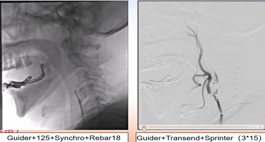 病历夹什么径技·第152期｜串联营病历夹：川陕大营_https://www.jmylbn.com_新闻资讯_第84张