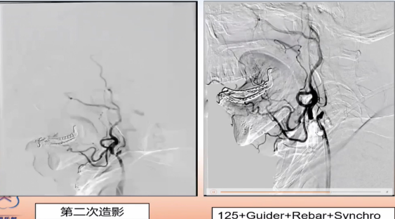 病历夹什么径技·第152期｜串联营病历夹：川陕大营_https://www.jmylbn.com_新闻资讯_第83张