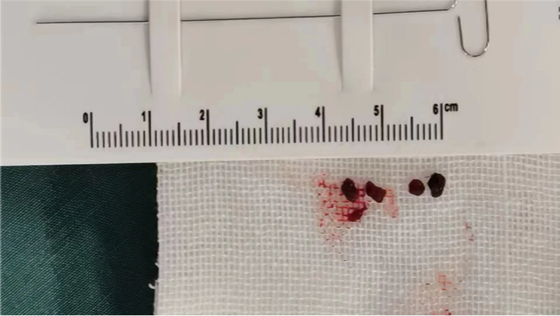 病历夹什么径技·第152期｜串联营病历夹：川陕大营_https://www.jmylbn.com_新闻资讯_第66张