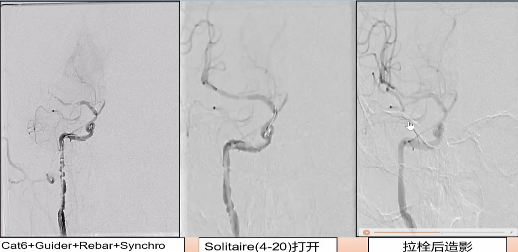 病历夹什么径技·第152期｜串联营病历夹：川陕大营_https://www.jmylbn.com_新闻资讯_第89张