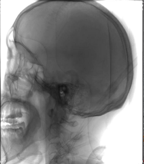 病历夹什么径技·第152期｜串联营病历夹：川陕大营_https://www.jmylbn.com_新闻资讯_第19张