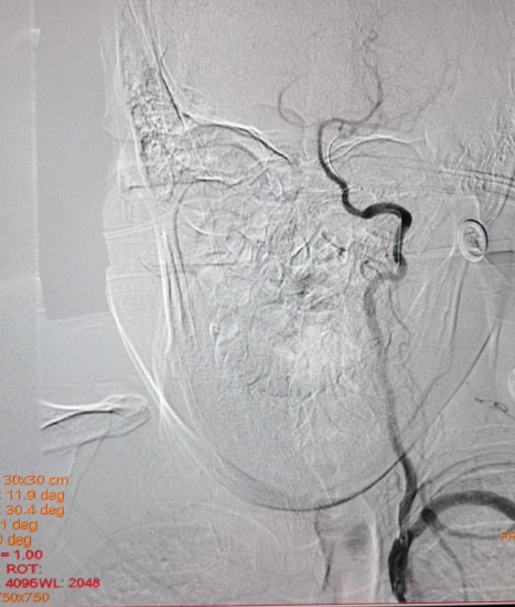 病历夹什么径技·第152期｜串联营病历夹：川陕大营_https://www.jmylbn.com_新闻资讯_第27张