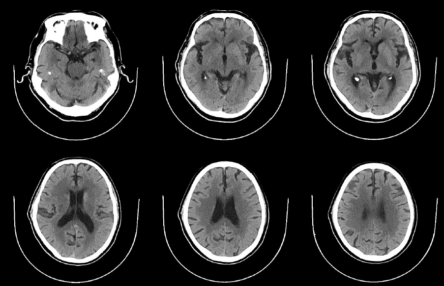 病历夹什么径技·第152期｜串联营病历夹：川陕大营_https://www.jmylbn.com_新闻资讯_第76张