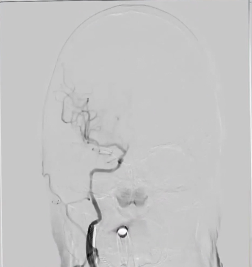 病历夹什么径技·第152期｜串联营病历夹：川陕大营_https://www.jmylbn.com_新闻资讯_第91张