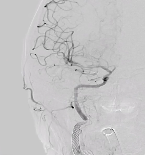 病历夹什么径技·第152期｜串联营病历夹：川陕大营_https://www.jmylbn.com_新闻资讯_第90张