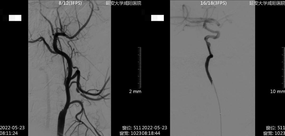 病历夹什么径技·第152期｜串联营病历夹：川陕大营_https://www.jmylbn.com_新闻资讯_第62张
