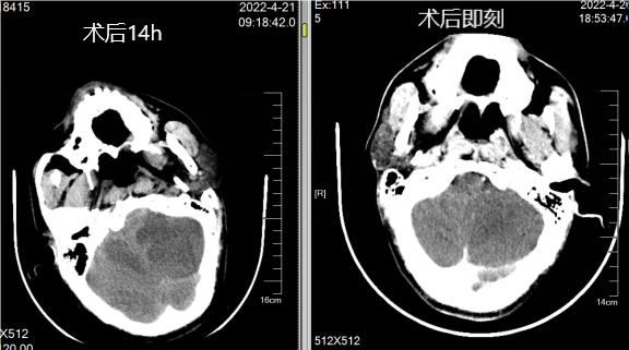病历夹什么径技·第152期｜串联营病历夹：川陕大营_https://www.jmylbn.com_新闻资讯_第29张
