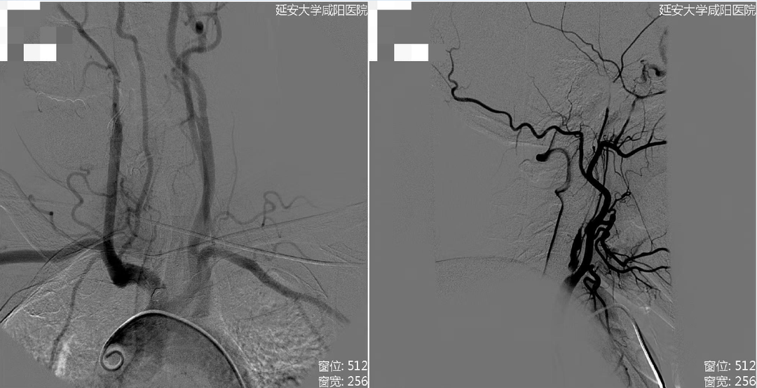 病历夹什么径技·第152期｜串联营病历夹：川陕大营_https://www.jmylbn.com_新闻资讯_第59张