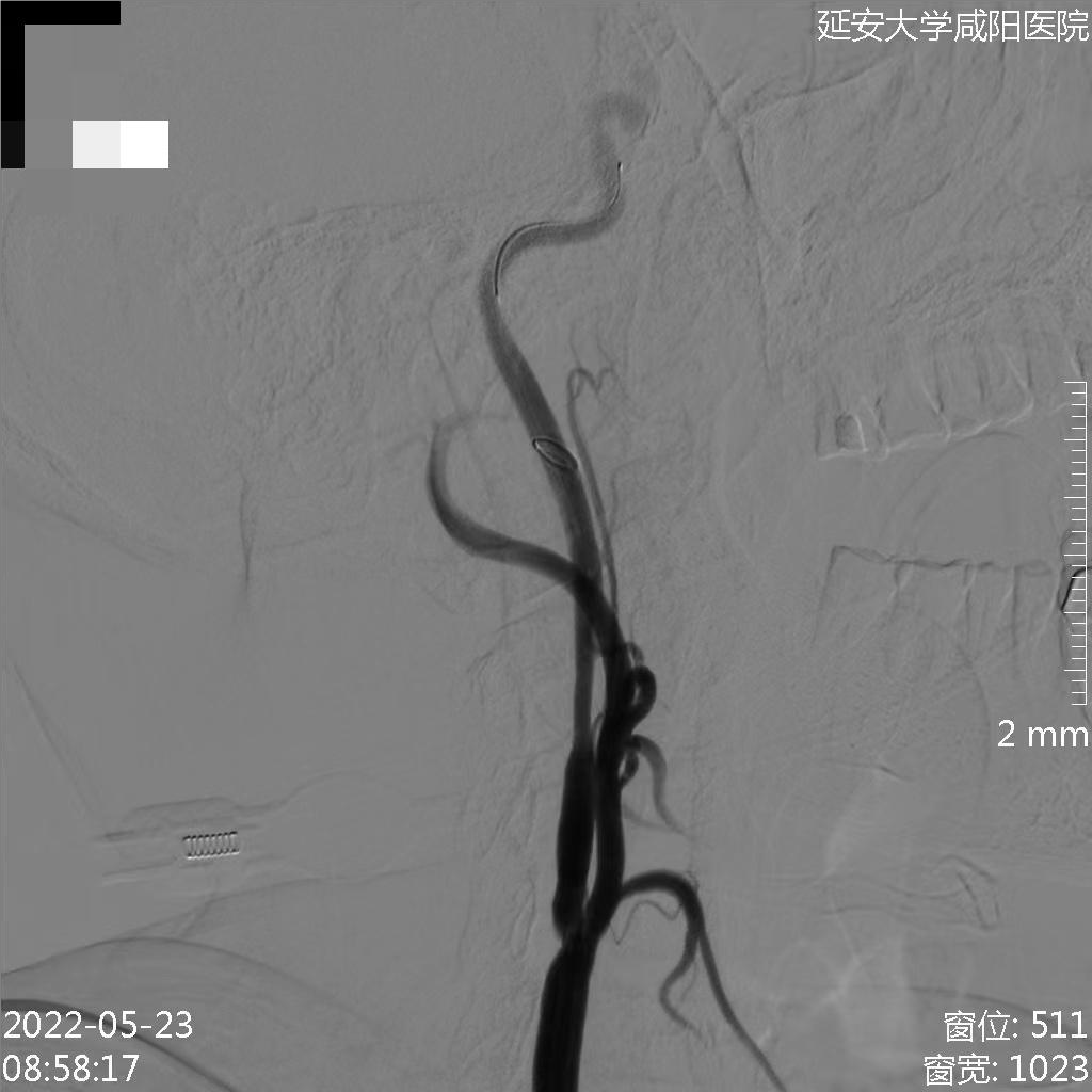 病历夹什么径技·第152期｜串联营病历夹：川陕大营_https://www.jmylbn.com_新闻资讯_第67张