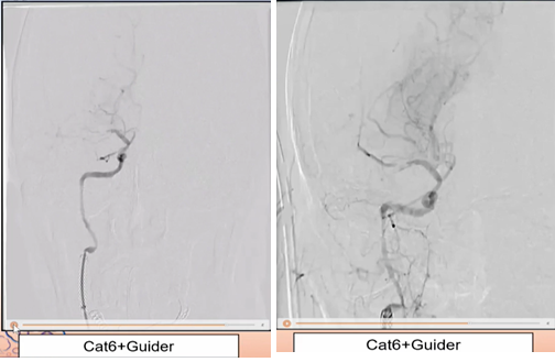 病历夹什么径技·第152期｜串联营病历夹：川陕大营_https://www.jmylbn.com_新闻资讯_第87张