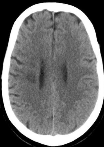 病历夹什么径技·第152期｜串联营病历夹：川陕大营_https://www.jmylbn.com_新闻资讯_第47张