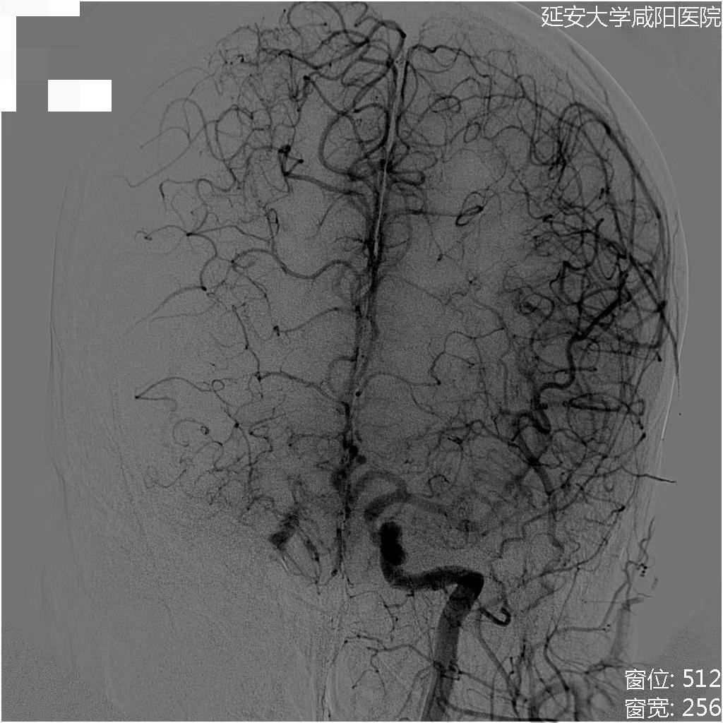 病历夹什么径技·第152期｜串联营病历夹：川陕大营_https://www.jmylbn.com_新闻资讯_第61张