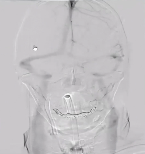 病历夹什么径技·第152期｜串联营病历夹：川陕大营_https://www.jmylbn.com_新闻资讯_第92张