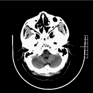 病历夹什么径技·第152期｜串联营病历夹：川陕大营_https://www.jmylbn.com_新闻资讯_第57张