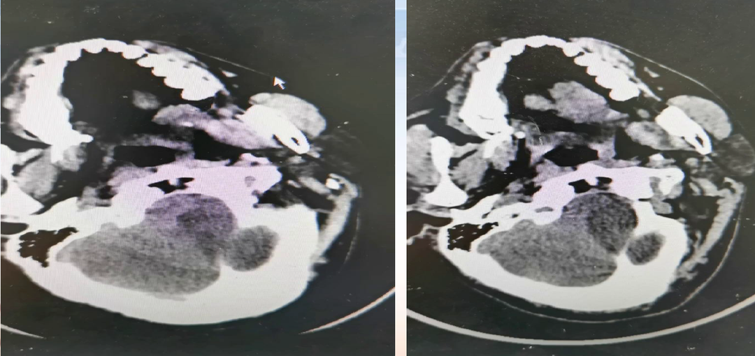 病历夹什么径技·第152期｜串联营病历夹：川陕大营_https://www.jmylbn.com_新闻资讯_第31张