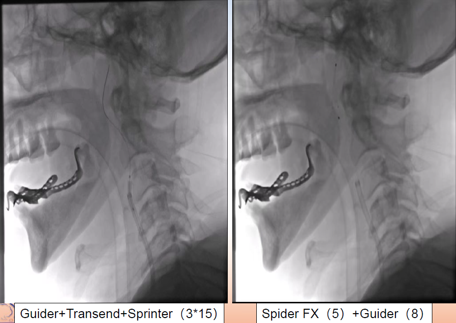 病历夹什么径技·第152期｜串联营病历夹：川陕大营_https://www.jmylbn.com_新闻资讯_第85张