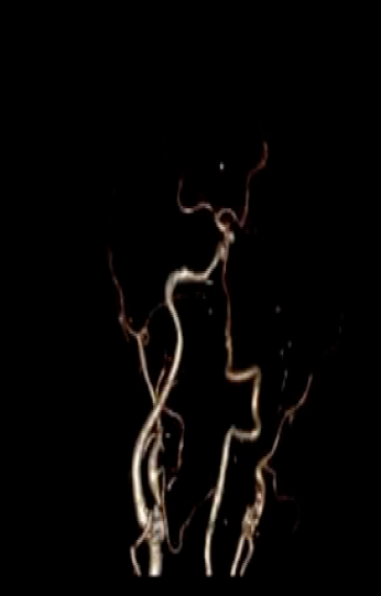 病历夹什么径技·第152期｜串联营病历夹：川陕大营_https://www.jmylbn.com_新闻资讯_第78张