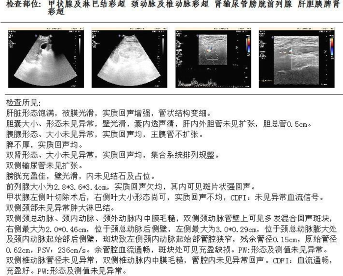 波科支架怎么样径技-弓上病例大赏｜第205期·放疗后症状性颈动脉狭窄支架置入治疗一例_https://www.jmylbn.com_新闻资讯_第8张