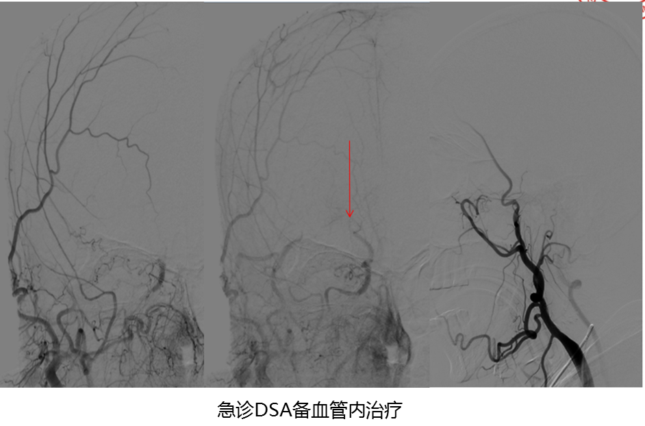 病历夹什么径技·第151期｜串联营病历夹：京广连营_https://www.jmylbn.com_新闻资讯_第49张